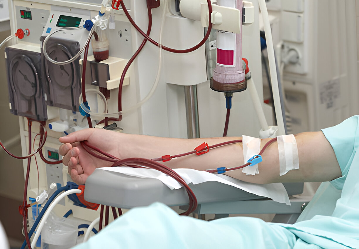 Patient helped during hemodialysis session in hospitalpatient helped during dialysis session in hospital