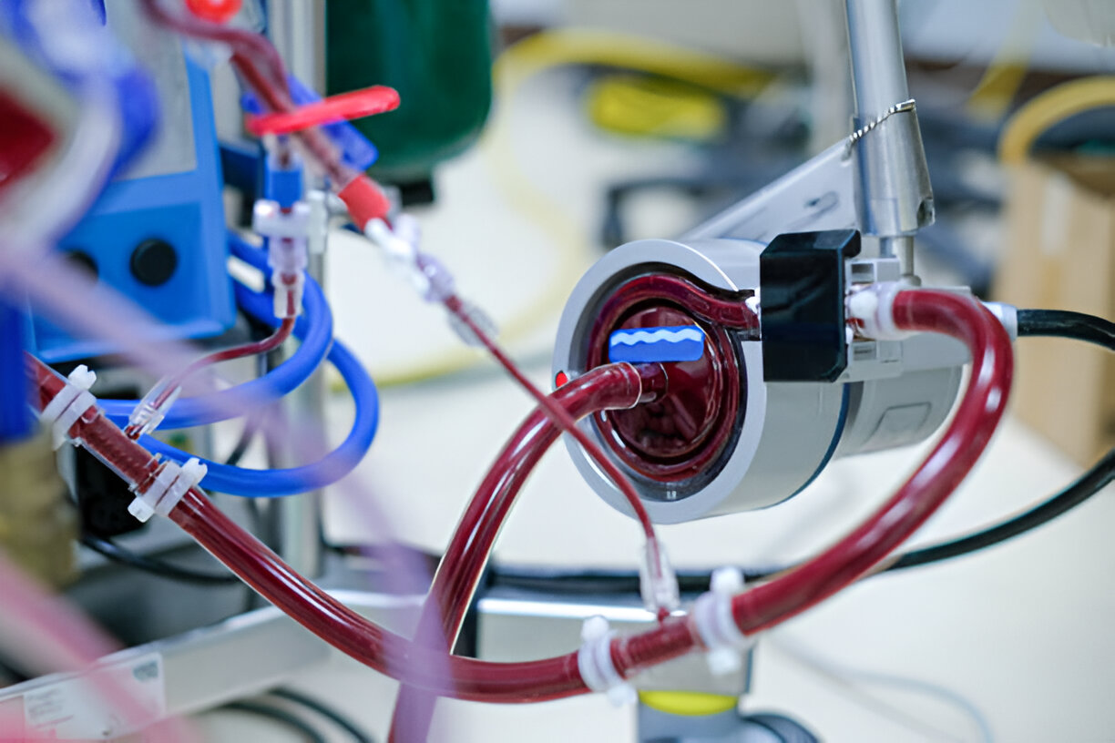 Close-up view of centrifugal pump which is a part of extracorporeal membrane oxygenation (ECMO) in critical care unit (CCU)